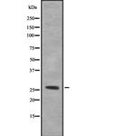MESDC2 Antibody in Western Blot (WB)