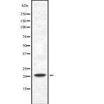 PDCD6 Polyclonal Antibody