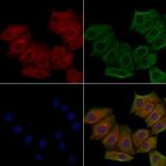 CA125 Polyclonal Antibody