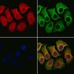 CA125 Antibody in Immunocytochemistry (ICC/IF)