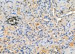 CA125 Antibody in Immunohistochemistry (Paraffin) (IHC (P))