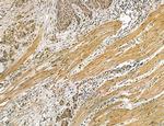 CA125 Antibody in Immunohistochemistry (Paraffin) (IHC (P))