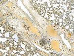 CA125 Antibody in Immunohistochemistry (Paraffin) (IHC (P))