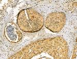 CA125 Antibody in Immunohistochemistry (Paraffin) (IHC (P))