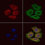 RASGRF1 Polyclonal Antibody