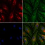 KATNA1 Polyclonal Antibody