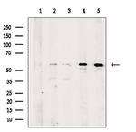KATNA1 Antibody in Western Blot (WB)