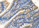 CYP3A5 Polyclonal Antibody