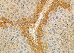 TRIM29 Polyclonal Antibody