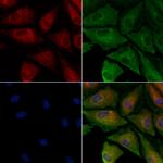 ATG4A Polyclonal Antibody