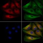 PTP4A2 Polyclonal Antibody