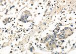 FRAT1 Polyclonal Antibody