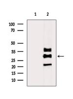 FRAT1 Antibody in Western Blot (WB)