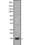 LGALS1 Polyclonal Antibody