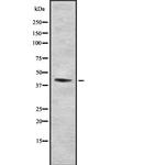 FNTA Polyclonal Antibody