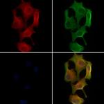 PTS Polyclonal Antibody