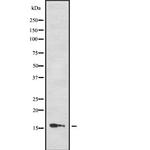 PTS Antibody in Western Blot (WB)