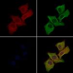 CDH4 Polyclonal Antibody