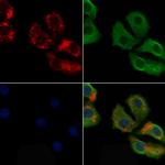 IGHG1 Polyclonal Antibody