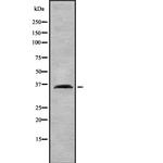 IGHG1 Antibody in Western Blot (WB)