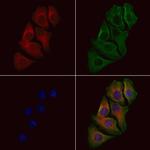 p39 Polyclonal Antibody