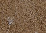 S100A2 Polyclonal Antibody
