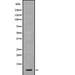 S100A2 Antibody in Western Blot (WB)