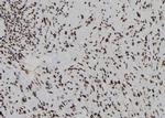 DUSP3 Polyclonal Antibody