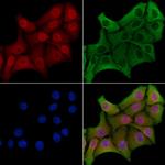 COPS8 Polyclonal Antibody