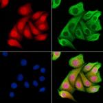 COPS8 Antibody in Immunocytochemistry (ICC/IF)
