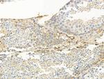 TRAM2 Antibody in Immunohistochemistry (Paraffin) (IHC (P))