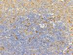 TRAM2 Antibody in Immunohistochemistry (Paraffin) (IHC (P))
