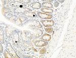 TRAM2 Antibody in Immunohistochemistry (Paraffin) (IHC (P))