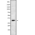 TRAP alpha Polyclonal Antibody