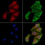 PPP1R9A Polyclonal Antibody
