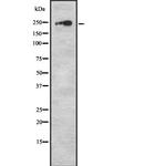 Factor V Antibody in Western Blot (WB)