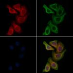 KIF3A Polyclonal Antibody