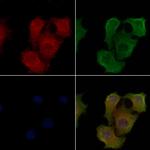 ORM2 Polyclonal Antibody