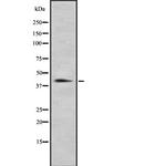 CDX4 Antibody in Western Blot (WB)