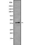 TMOD2 Polyclonal Antibody