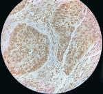 S100P Polyclonal Antibody