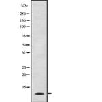 S100P Antibody in Western Blot (WB)