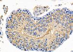 GDF1 Antibody in Immunohistochemistry (Paraffin) (IHC (P))