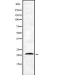 Dynactin 3 Polyclonal Antibody