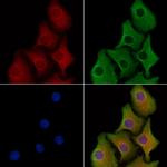 CAP2 Polyclonal Antibody