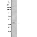 HLA-DR/DP Polyclonal Antibody
