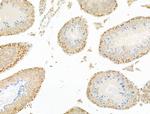 MCRS1 Antibody in Immunohistochemistry (Paraffin) (IHC (P))