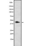 LHX3 Polyclonal Antibody