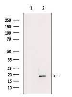 FLAP Polyclonal Antibody