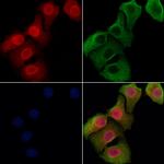 CHD5 Polyclonal Antibody